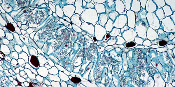 Tratamientos de la piel con probióticos y prebióticos